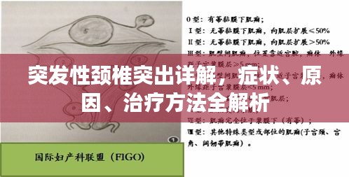 突發(fā)性頸椎突出詳解，癥狀、原因、治療方法全解析