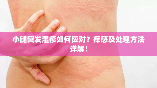 小腿突發(fā)濕疹如何應(yīng)對(duì)？癢感及處理方法詳解！