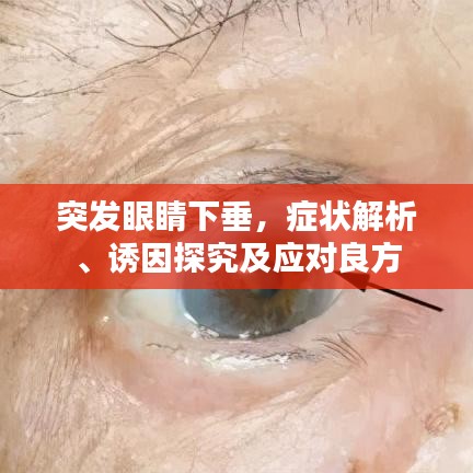 突發(fā)眼睛下垂，癥狀解析、誘因探究及應對良方