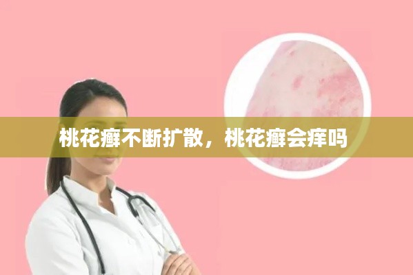 桃花癬不斷擴散，桃花癬會癢嗎 