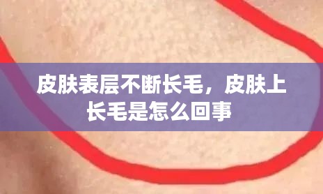 皮膚表層不斷長(zhǎng)毛，皮膚上長(zhǎng)毛是怎么回事 