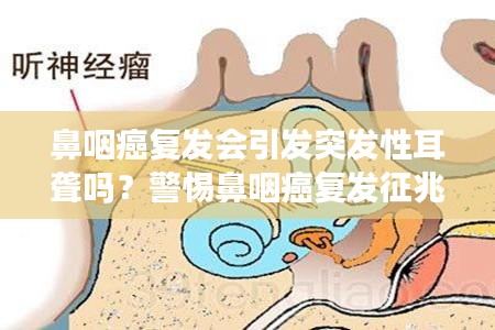 鼻咽癌復(fù)發(fā)會引發(fā)突發(fā)性耳聾嗎？警惕鼻咽癌復(fù)發(fā)征兆！