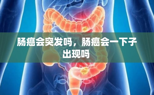 腸癌會突發(fā)嗎，腸癌會一下子出現(xiàn)嗎 