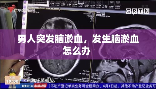 男人突發(fā)腦淤血，發(fā)生腦淤血怎么辦 