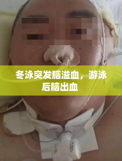 冬泳突發(fā)腦溢血，游泳后腦出血 