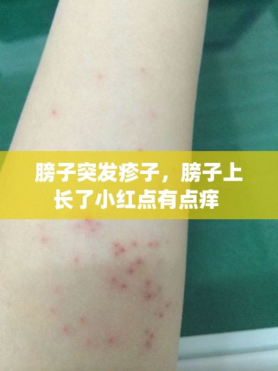 膀子突發(fā)疹子，膀子上長了小紅點有點癢 