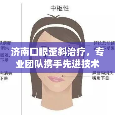 濟(jì)南口眼歪斜治療，專業(yè)團(tuán)隊(duì)攜手先進(jìn)技術(shù)，療效顯著