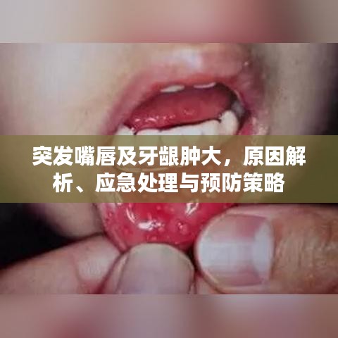 突發(fā)嘴唇及牙齦腫大，原因解析、應急處理與預防策略