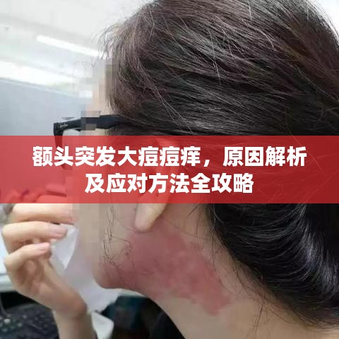 額頭突發(fā)大痘痘癢，原因解析及應(yīng)對(duì)方法全攻略