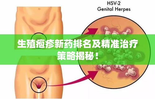 生殖皰疹新藥排名及精準(zhǔn)治療策略揭秘！