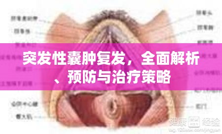 突發(fā)性囊腫復(fù)發(fā)，全面解析、預(yù)防與治療策略