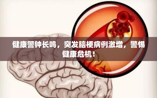 健康警鐘長鳴，突發(fā)腦梗病例激增，警惕健康危機！