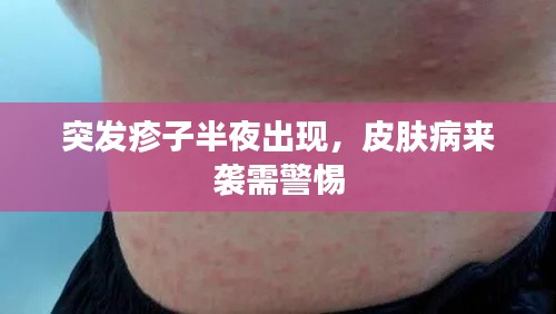 突發(fā)疹子半夜出現(xiàn)，皮膚病來襲需警惕
