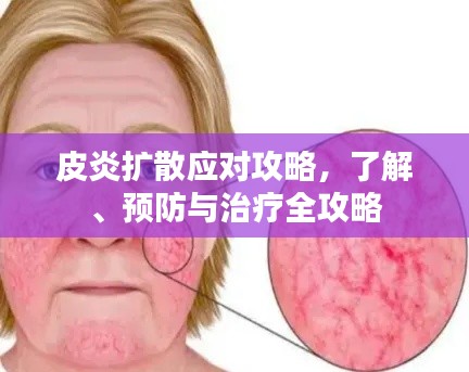 皮炎擴(kuò)散應(yīng)對(duì)攻略，了解、預(yù)防與治療全攻略