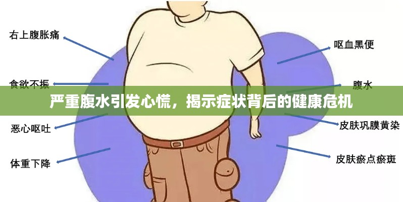 嚴(yán)重腹水引發(fā)心慌，揭示癥狀背后的健康危機(jī)