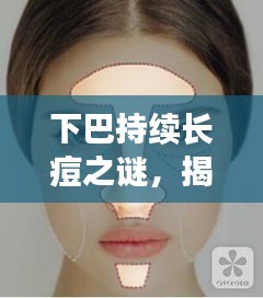 下巴持續(xù)長痘之謎，揭秘36歲人群的挑戰(zhàn)與應(yīng)對之道